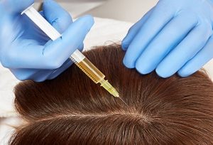 Saç Mezoterapisi Nasıl Yapılır